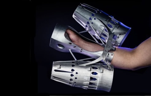 Arm mount with 3D printed parts, leading to weight and cost reductions by changing material, functional integration and bionic design optimizations (source: EOS)